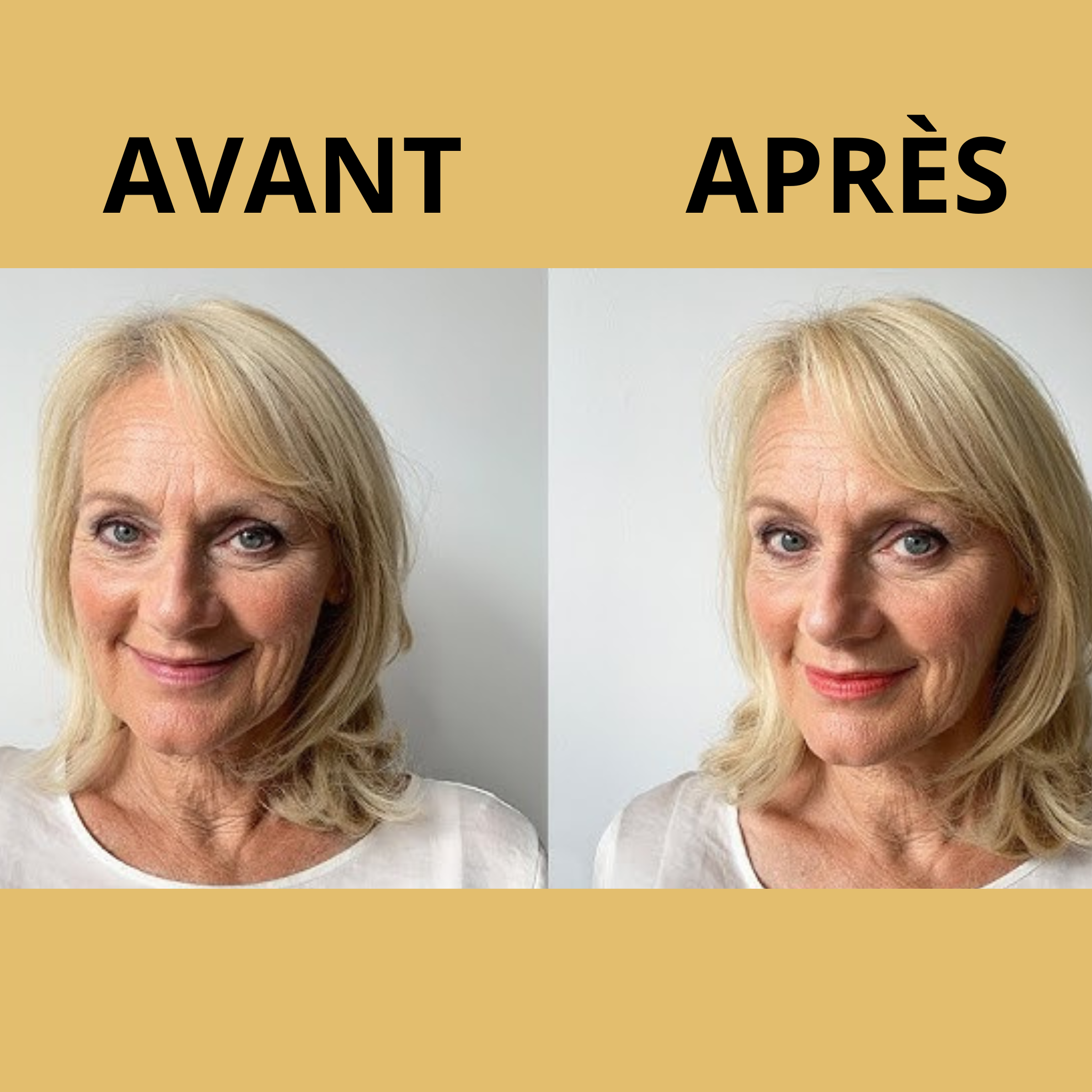 Zoumy™ | Lèvres Sublimes au Naturel