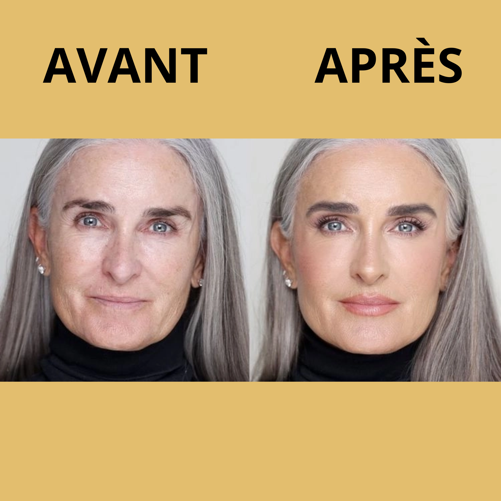 Zoumy™ | Lèvres Sublimes au Naturel