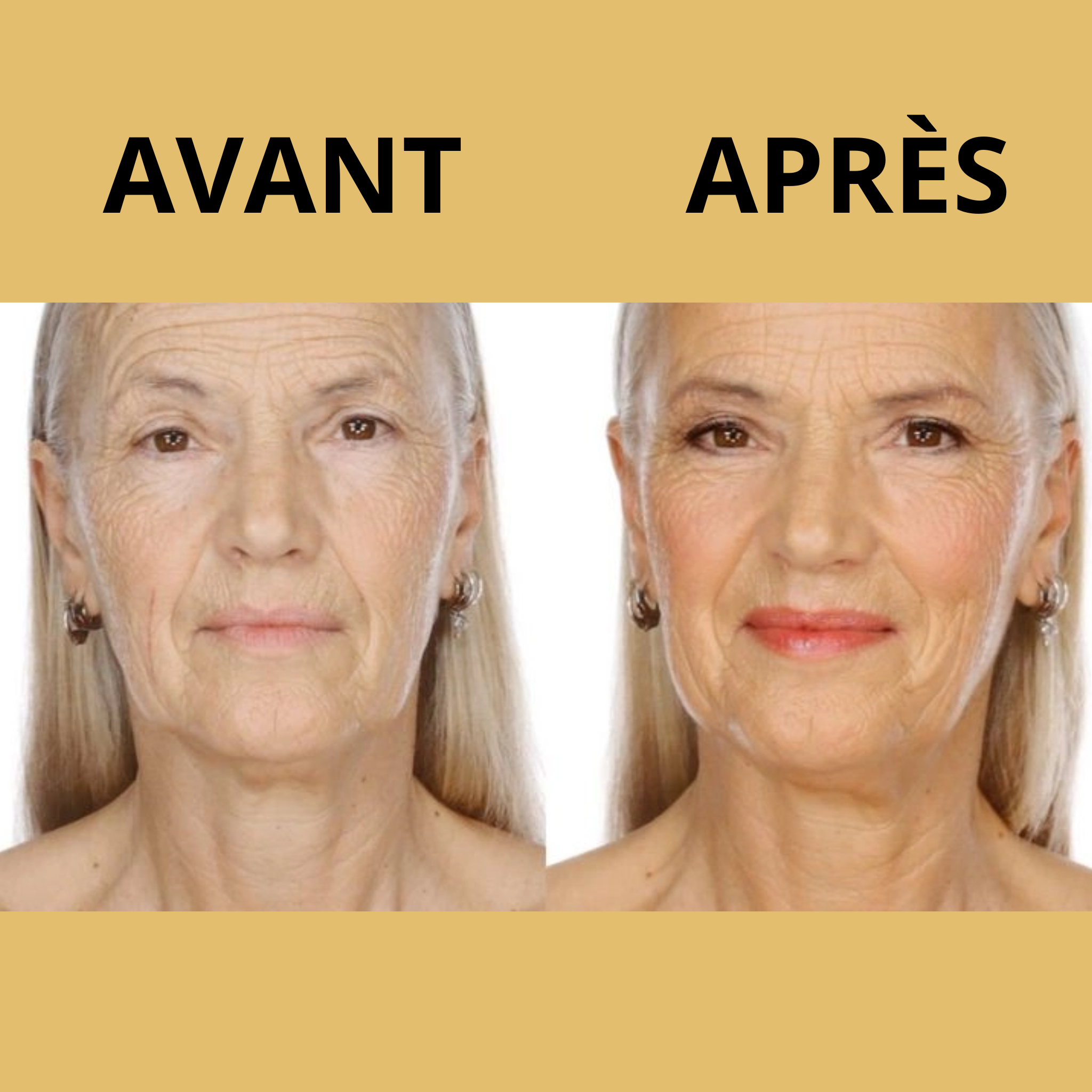 Zoumy™ | Lèvres Sublimes au Naturel